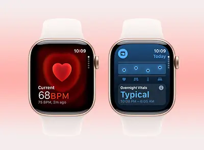 Prime Member Deals 2025 71 Apple Watch Series 10